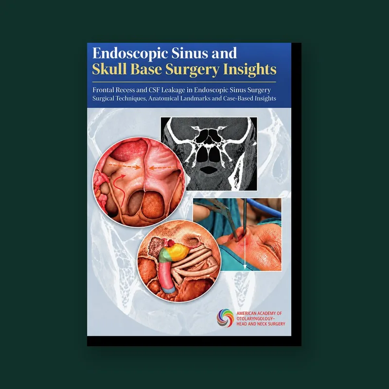 Cover of Endoscopic Sinus and Skull Base Surgery Insights
